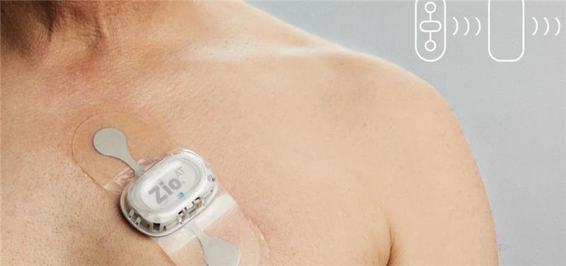  EKG Monitor