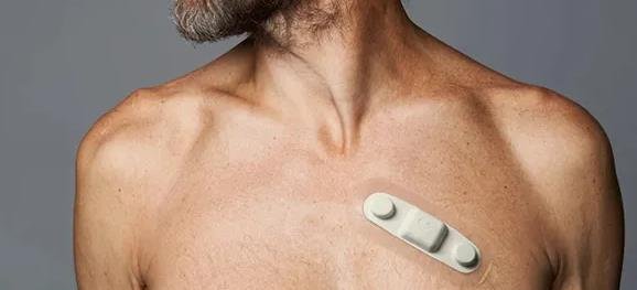  EKG Monitor